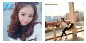 超声波双眼皮为颜值加分226 超声波双眼皮为颜值加分226