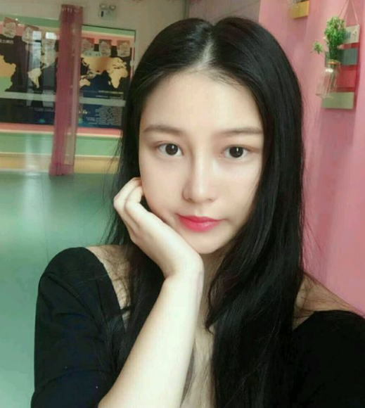 不开刀隆鼻后我的新生活开始了803 不开刀隆鼻后我的新生活开始了803