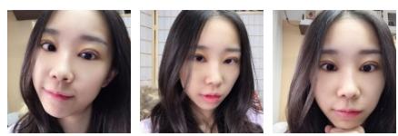 做完超声波双眼皮,简直让我判若两人561 做完超声波双眼皮,简直让我判若两人561