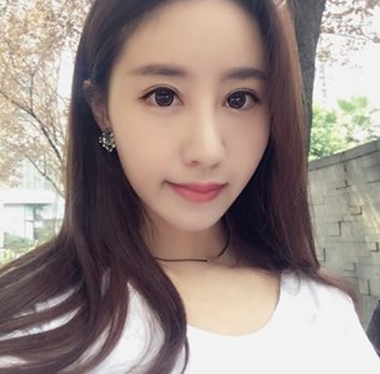 我美丽的双眼皮就是做超声波双眼皮做出来的207 我美丽的双眼皮就是做超声波双眼皮做出来的207