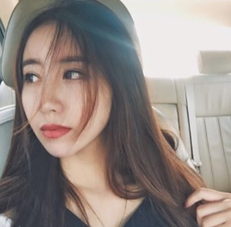 我美丽的双眼皮就是做超声波双眼皮做出来的207 我美丽的双眼皮就是做超声波双眼皮做出来的207