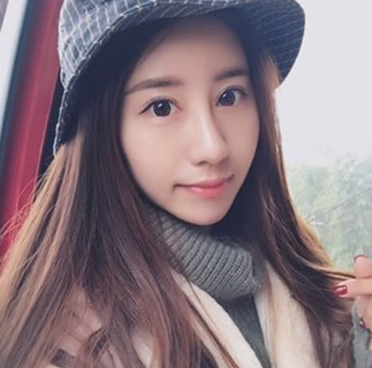 烦人得眼袋做le超 声 波去眼袋以后没有le 烦人得眼袋做le超 声 波去眼袋以后没有le