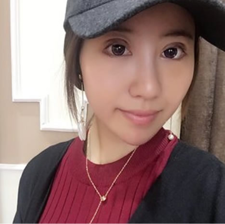 做了超声波双眼皮轻松做大眼美女244 做了超声波双眼皮轻松做大眼美女244