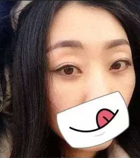 超声波去眼袋珍贵的人生经历455 超声波去眼袋珍贵的人生经历455
