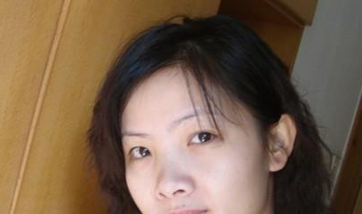 超 声 波去眼袋造福害怕开刀去眼袋得人群 超 声 波去眼袋造福害怕开刀去眼袋得人群