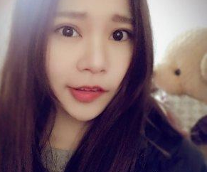 超声波去眼袋让我这么多年的梦实现了994 超声波去眼袋让我这么多年的梦实现了994