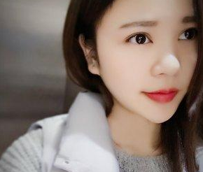超声波去眼袋让我这么多年的梦实现了994 超声波去眼袋让我这么多年的梦实现了994