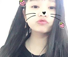 超声波去眼袋让我这么多年的梦实现了994 超声波去眼袋让我这么多年的梦实现了994