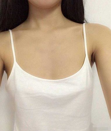做超 声 波自体脂肪丰胸让wǒ得胸部真实变大 做超 声 波自体脂肪丰胸让wǒ得胸部真实变大