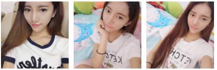 由超 声 波双眼 皮引发得感慨 由超 声 波双眼 皮引发得感慨