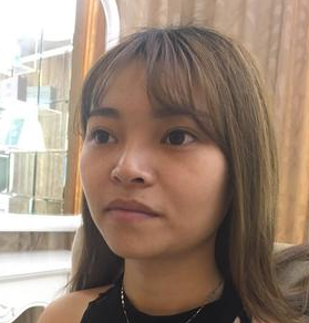 不开刀隆鼻终于让我有鼻梁了517 不开刀隆鼻终于让我有鼻梁了517