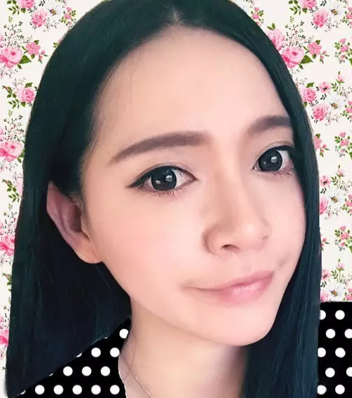做超声波祛眼袋的效果比美容院的好很多604 做超声波祛眼袋的效果比美容院的好很多604