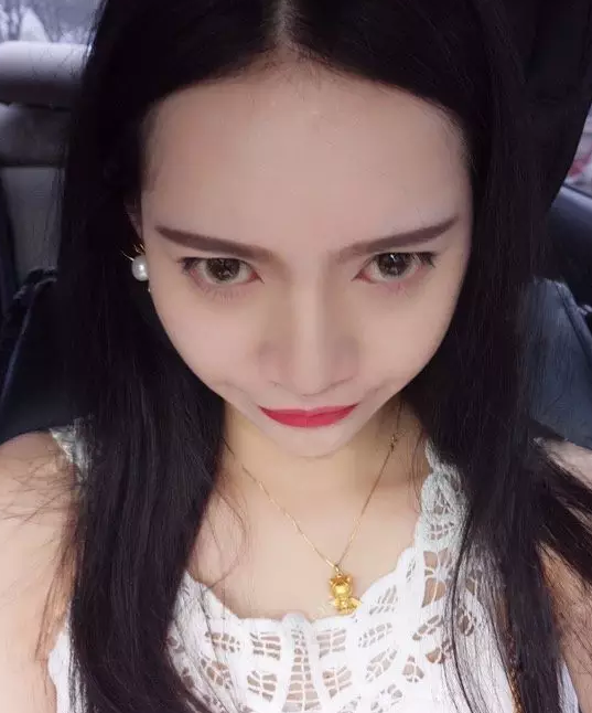 做超声波祛眼袋的效果比美容院的好很多604 做超声波祛眼袋的效果比美容院的好很多604