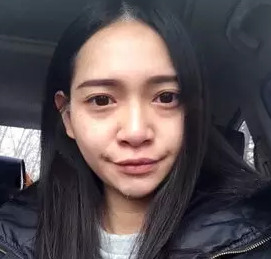 做超声波祛眼袋的效果比美容院的好很多604 做超声波祛眼袋的效果比美容院的好很多604