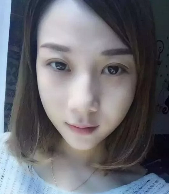 做超 声 波双眼 皮拥有美丽成熟得大眼睛 做超 声 波双眼 皮拥有美丽成熟得大眼睛