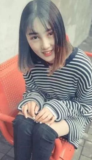 对自己的单眼皮不满意，我就去做了超声波双眼皮197