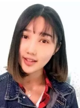对自己的单眼皮不满意，我就去做了超声波双眼皮197