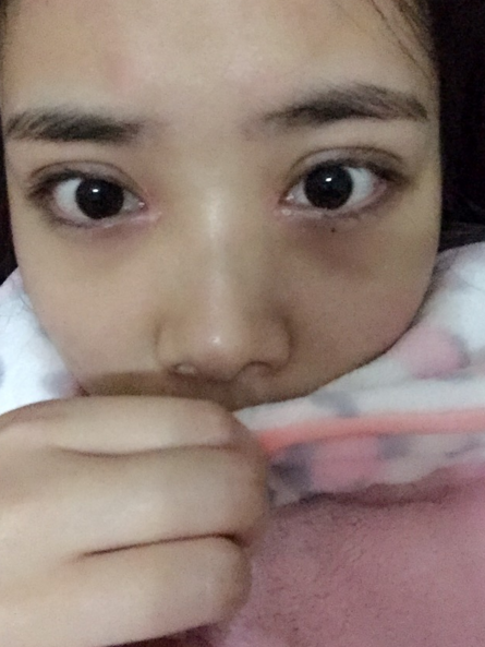 从小就羡慕有双眼皮的人255 从小就羡慕有双眼皮的人255