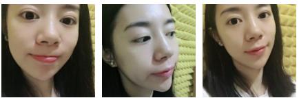感谢超声波去眼袋---没眼袋好轻松199 感谢超声波去眼袋---没眼袋好轻松199
