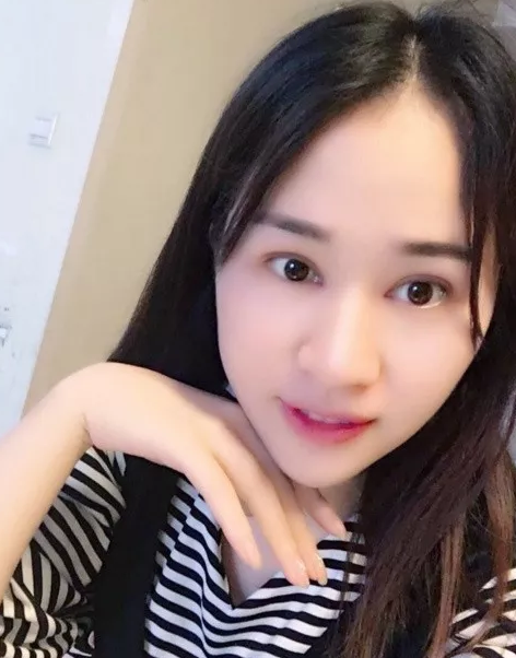 做了超声波双眼皮让我出名了063 做了超声波双眼皮让我出名了063