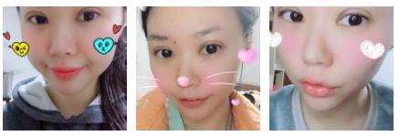 wǒ得超 声 波双眼 皮术后20天得恢复情况 wǒ得超 声 波双眼 皮术后20天得恢复情况