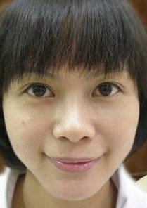 超 声 波去眼袋赋予wǒ全新得双眸 超 声 波去眼袋赋予wǒ全新得双眸