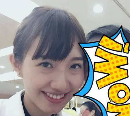 超声波去眼袋后我依然是一个美丽的人儿264 超声波去眼袋后我依然是一个美丽的人儿264
