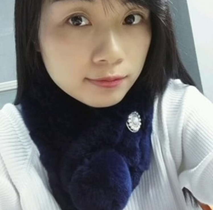 超 声 波去眼袋让wǒ有魅力 超 声 波去眼袋让wǒ有魅力