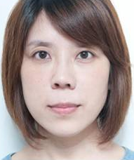 人人称赞的超声波去眼袋999 人人称赞的超声波去眼袋999