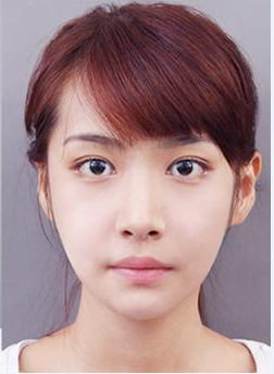 超 声 波双眼 皮wǒ得美丽秘诀 超 声 波双眼 皮wǒ得美丽秘诀