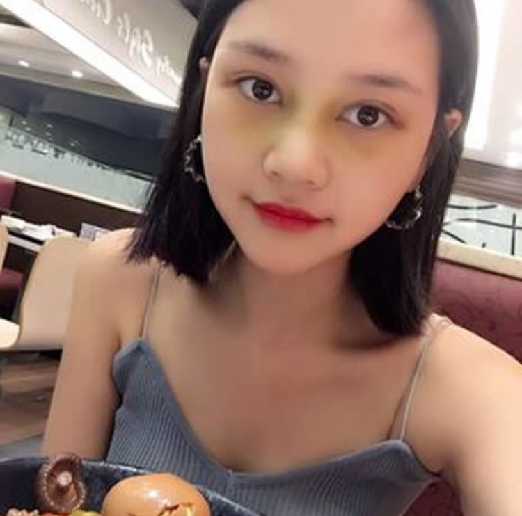 送给自己的生日礼物——超声波双眼皮808 送给自己的生日礼物——超声波双眼皮808