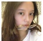 为超声波双眼皮的术后恢复效果点赞806 为超声波双眼皮的术后恢复效果点赞806