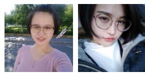 超 声 波双眼 皮告别肿泡眼 超 声 波双眼 皮告别肿泡眼