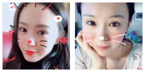 超声波双眼皮让我变美啦375 超声波双眼皮让我变美啦375