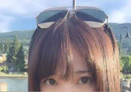 去眼袋,它是一个好办法278 去眼袋,它是一个好办法278