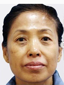 女儿给我买房子还带我做彭式童颜术让我变年轻930 女儿给我买房子还带我做彭式童颜术让我变年轻930
