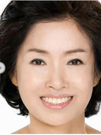 女儿给我买房子还带我做彭式童颜术让我变年轻930 女儿给我买房子还带我做彭式童颜术让我变年轻930