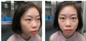 超 声 波去眼袋帮wǒ解决超大眼袋 超 声 波去眼袋帮wǒ解决超大眼袋