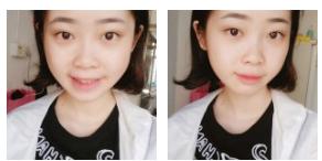 超 声 波去眼袋帮wǒ解决超大眼袋 超 声 波去眼袋帮wǒ解决超大眼袋