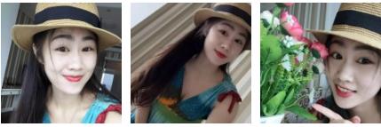 超声波去眼袋给我一双爱笑的眼睛764 超声波去眼袋给我一双爱笑的眼睛764