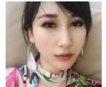 超声波去眼袋真是一劳永逸874 超声波去眼袋真是一劳永逸874