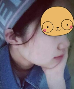 不开刀隆鼻让我变成拍照达人499 不开刀隆鼻让我变成拍照达人499