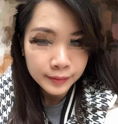 我也做了不开刀隆鼻,美啦美啦590 我也做了不开刀隆鼻,美啦美啦590