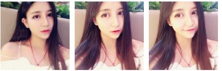 超声波双眼皮的效果确实很棒668 超声波双眼皮的效果确实很棒668