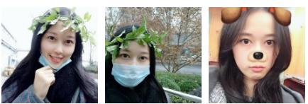 超 声 波双眼 皮让wǒ变漂亮啦! 超 声 波双眼 皮让wǒ变漂亮啦!