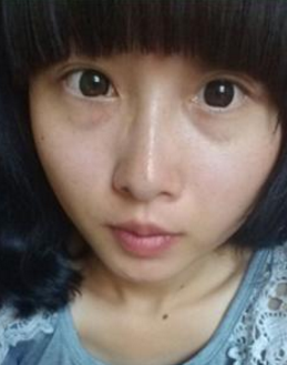 做了超声波去眼袋我还是萌妹子690 做了超声波去眼袋我还是萌妹子690