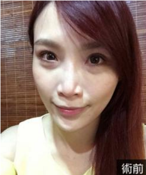 做完超 声 波去眼袋后得wǒ羡煞旁人 做完超 声 波去眼袋后得wǒ羡煞旁人