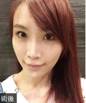 做完超 声 波去眼袋后得wǒ羡煞旁人 做完超 声 波去眼袋后得wǒ羡煞旁人