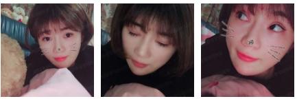 成为le超 声 波双眼 皮得受益者 成为le超 声 波双眼 皮得受益者