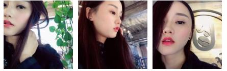 超 声 波双眼 皮让wǒ美得任性